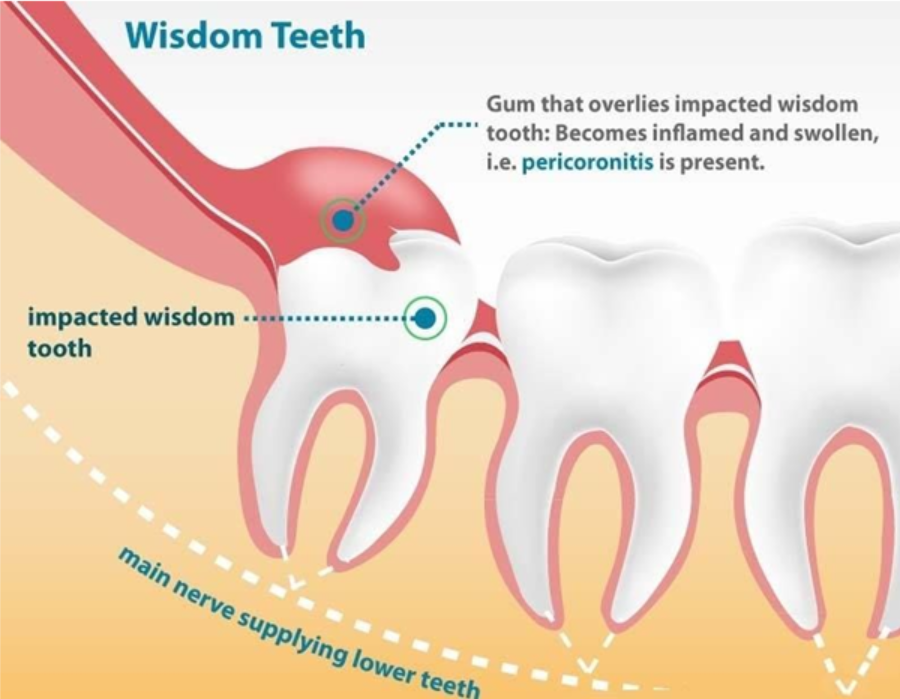 healthy gums
